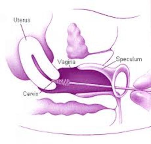 Pap Test (21)