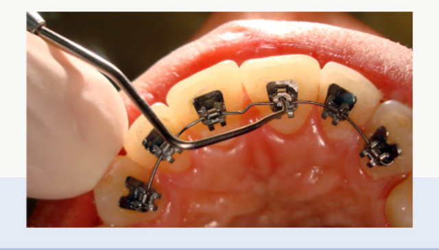 Concluiu o módulo avançado de Ortodontia Lingual