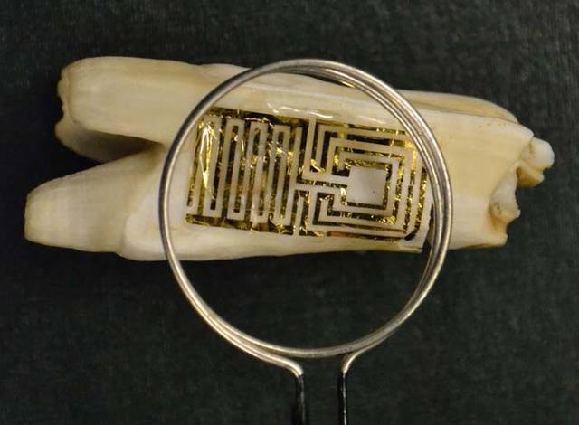 Tooth 'Tattoo' Sensor