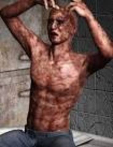 Shakespeare Comes Down With the "Plauge"