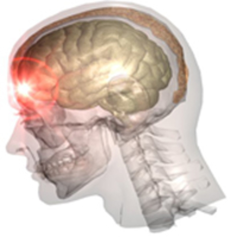 eighty-seven days before