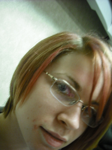 Got LASIK eye surgery