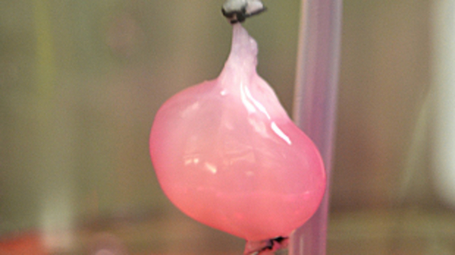 First kidney grown in vitro in the US