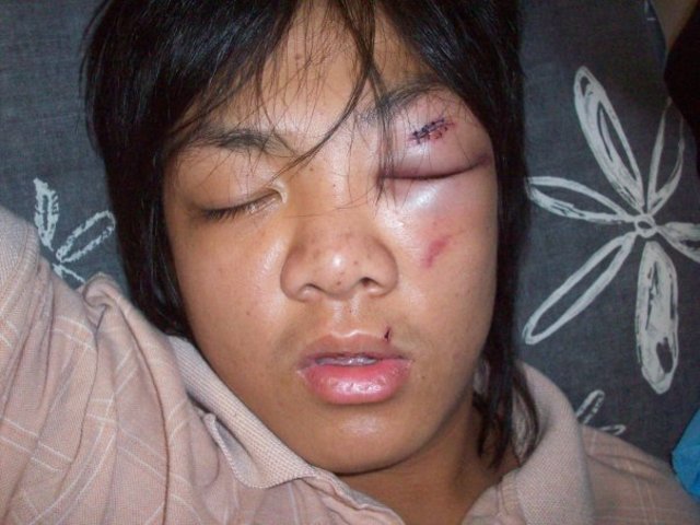 Getting Hit by a Car   (Physical)