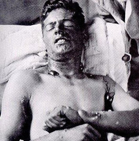 the first use of gas