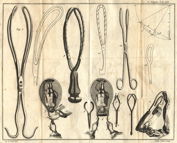 Obstetrical Forceps Popularized in Europe