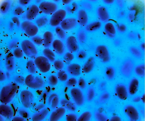 Robert Koch confirms the Germ Theory of Disease