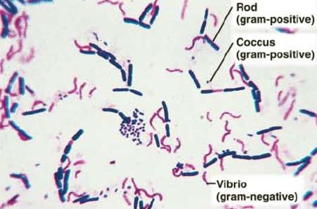 Hans Christian Gram creates the gram stain