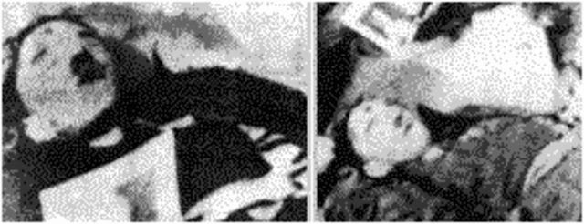 Hitler Committed Suicide