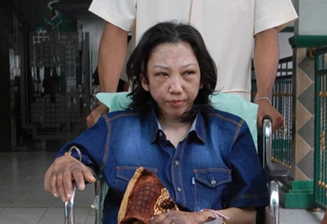 Abuse case of Erwiana