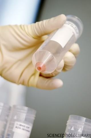 Aislar el material genético