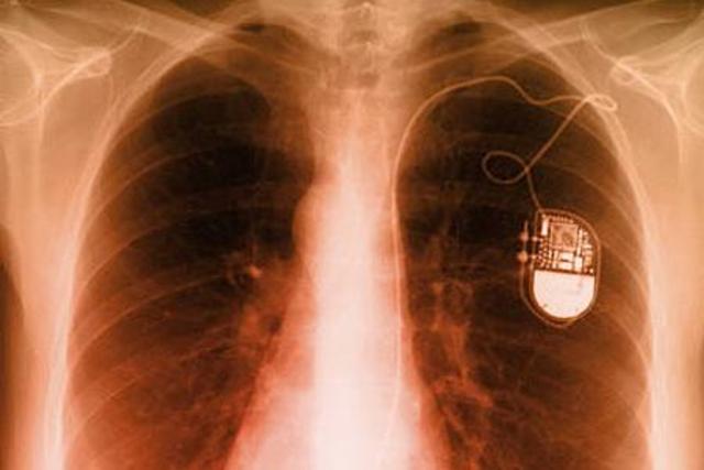 Nachhilfe fürs Herz