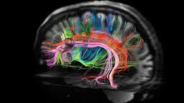 Better Understanding of the Brain