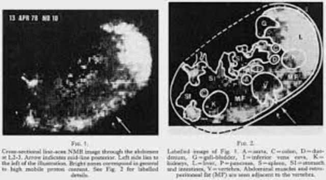 Magnetic Resonance Imaging