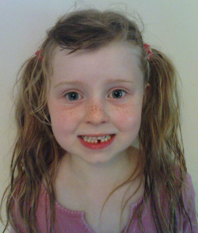 My first tooth out