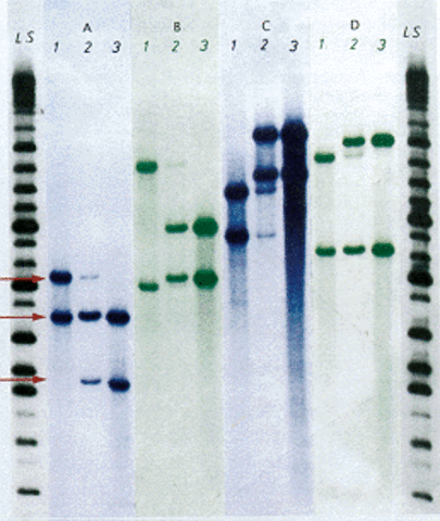 Se utiliza por primera vez la " ADN fingerprinting" (huella genética) en una investigación judicial en Gran Bretaña.