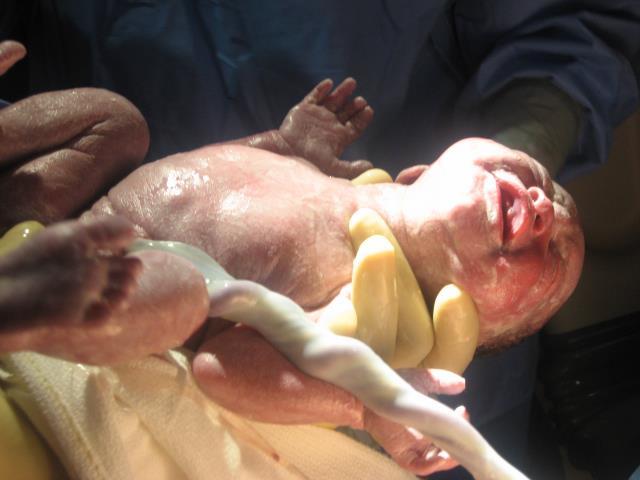 MY 2nd Child was born