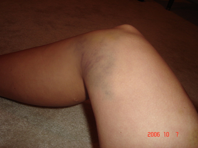 Adulthood: Biosocial Development