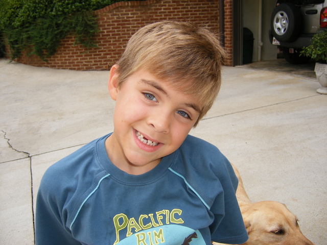 Lost my first front tooth!