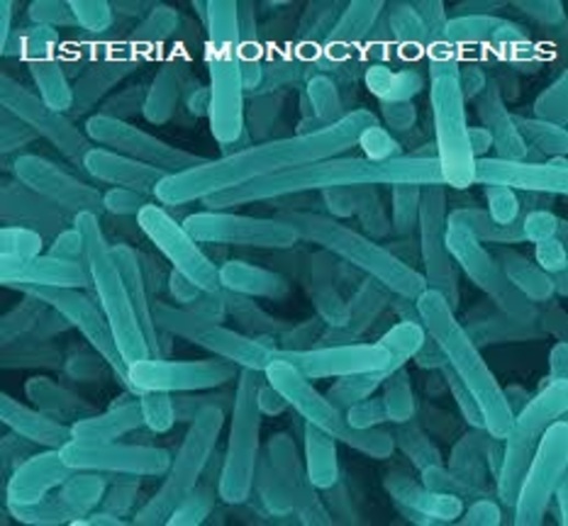 LISTERIOSI