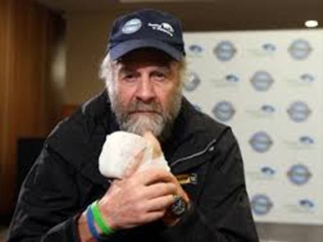 crabbe goes to the hospital with forstbite on his left hand