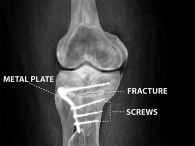 i've fell down and by god i got up