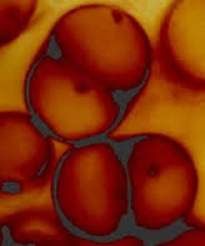 Matthias Schleiden Theorizes that everything is made of cells