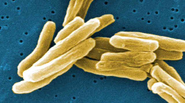 Robert Koch discovers anthrax, tuberculosis and cholera