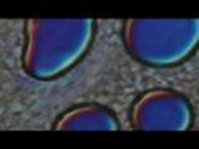 Germ theory origins.