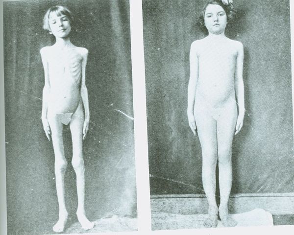 DISCOVERED THE CHEMICAL STRUCTURE OF INSULIN