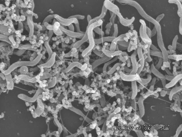 Discovery of Microbes