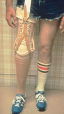 Attatchment using Atmospheric Pressure