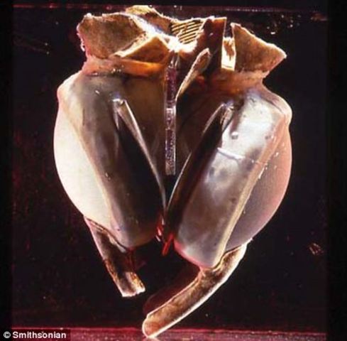 Artificial Heart Invented