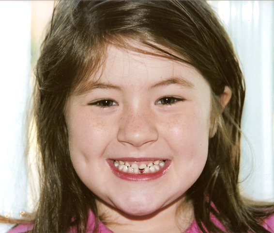 First Lost Tooth