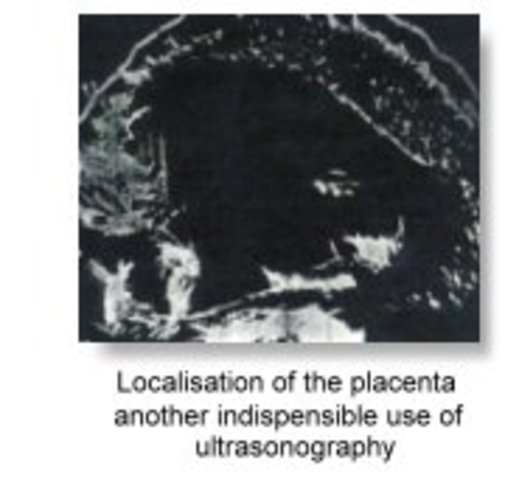 Ultrasound in OB/GYN