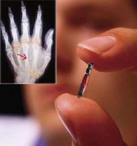 RFID Implants are necessary