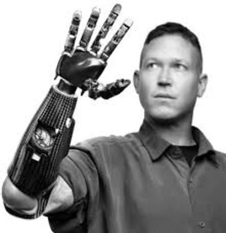 Modern Prosthetics 2000-