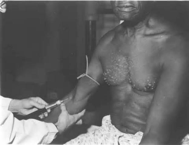 Congressional Hearing end for Tuskegee Study