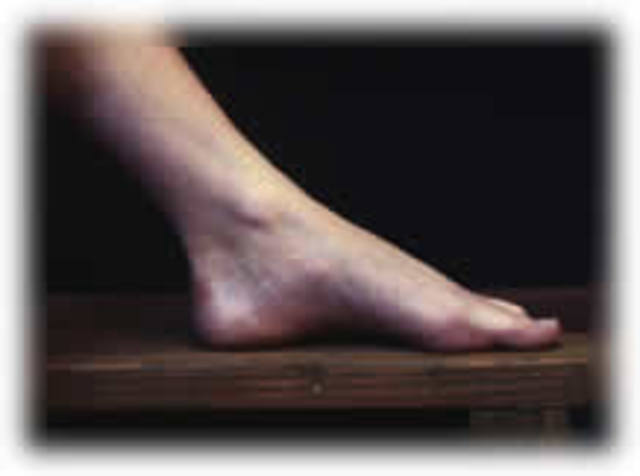 Magister Kless verberabat Iacobum pedibus ferociter.