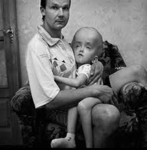 The Chernobyl Disaster