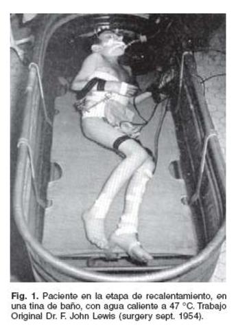 Cirugia a corazón abierto