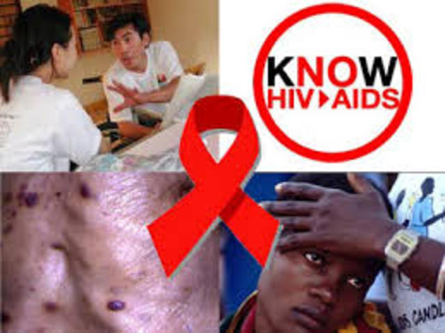 HIV/AIDS