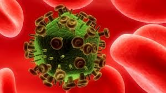 HIV AND AIDS