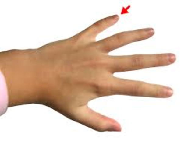 Slammed My Finger (Biosocial)