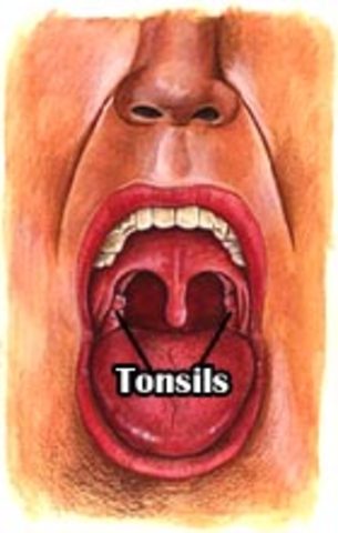 Yo tuve mi amígdalas quitó en veintiuno de deciembre en dos mil seis.