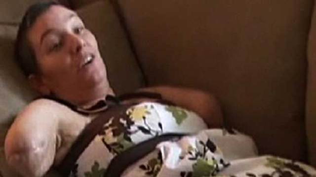 crabbe finds out he got amputated