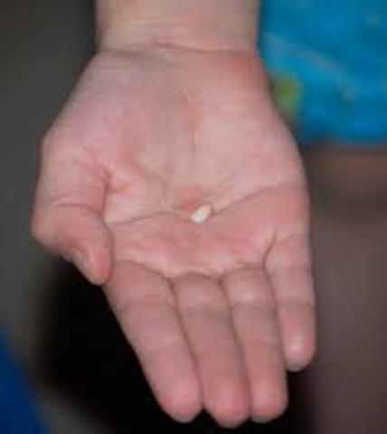 yo perdido mi primeo diente