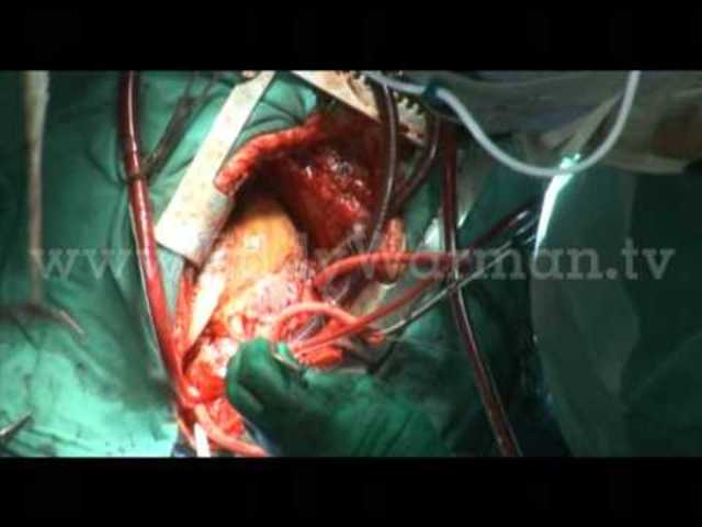 Avenços en medicina