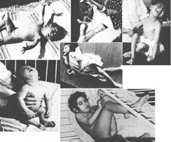 Enfermedad de Minamata