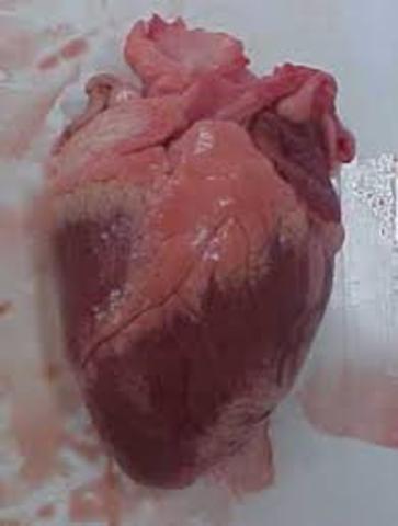 Primer transplantament de cor.